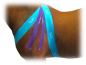 Preview: Equi-Tape® Advantage, purple, 5m x 7,5cm