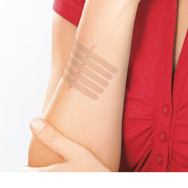 Leukosan® Strip Wundnahtstreifen